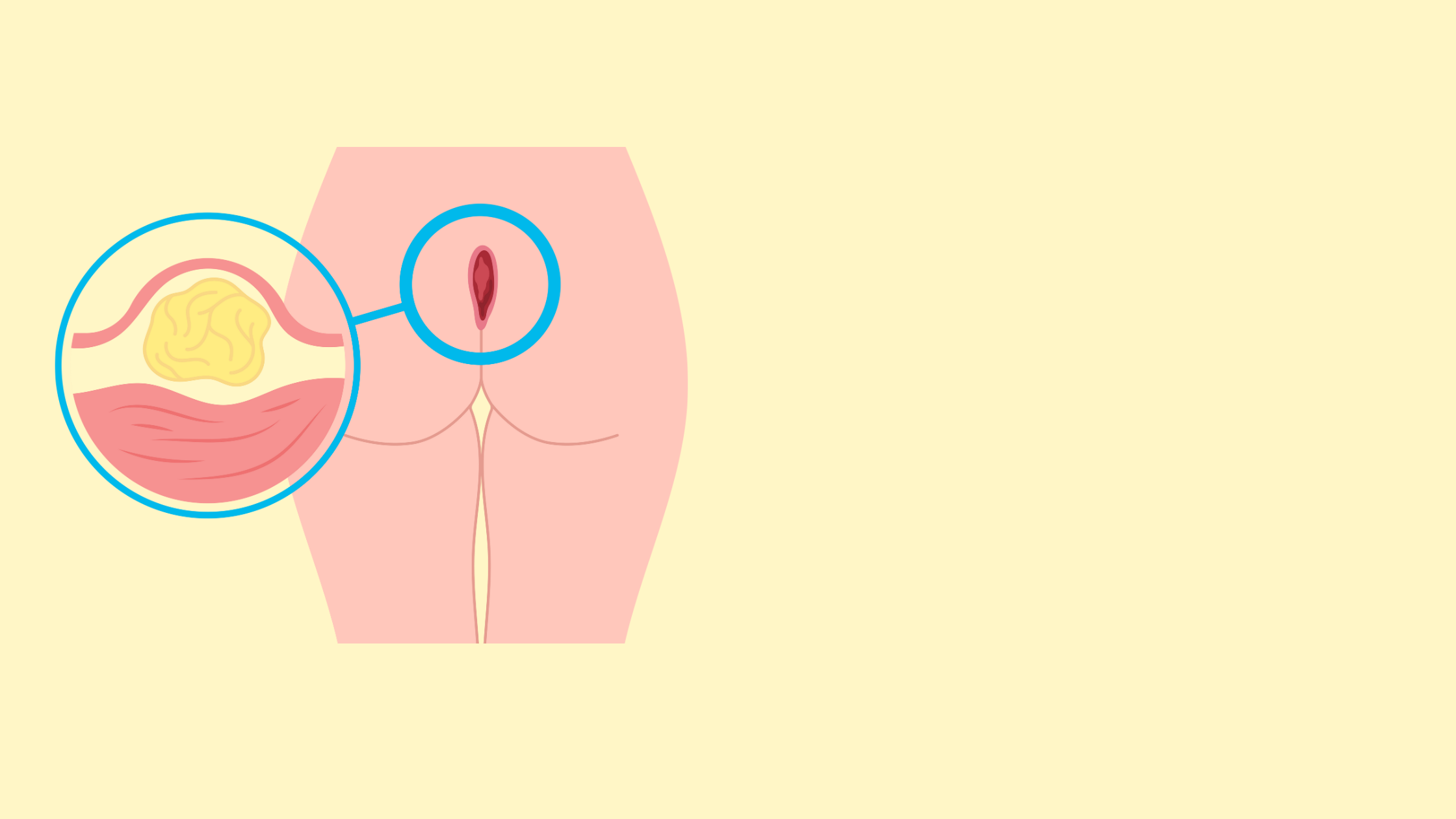 Untitled design (6)